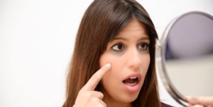 أسباب ظهور الهالات السوداء 